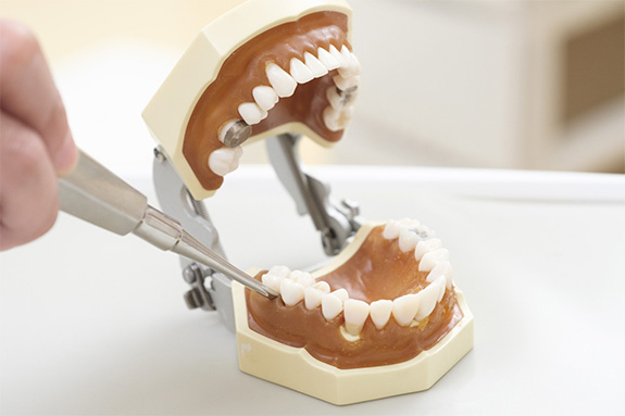 写真：矯正歯科のイメージ